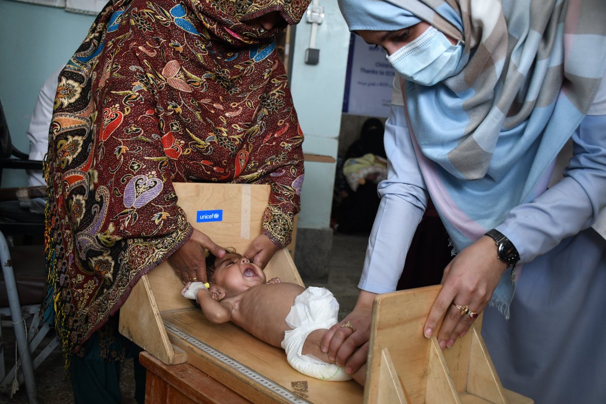 UNICEFAfg's tweet photo. Severe wasting is when children are too thin for their height resulting in weakened immune systems–the most visible &amp; life-threatening form of malnutrition. In Afg, 1.1 million children are at risk of severe wasting this year -- double the # in 2018. Rd👇https://t.co/Q6Y8QjHa6h https://t.co/79F2X2AgYu