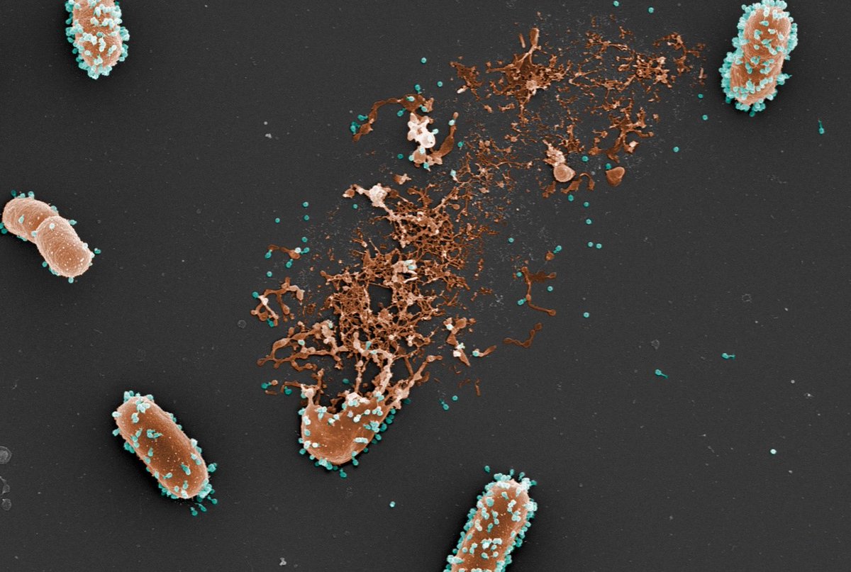 Inserm's tweet photo. #Antibiorésistance

Des scientifiques ont développé un #modèle prédictif de l’efficacité de la #phagothérapie. Il pourrait aussi être utilisé pour tester des thérapies anti-infectieuses fondées sur l’association entre #bactériophages et #antibiotiques 💊

https://t.co/5pFUTX993X https://t.co/AuQBoGK81S