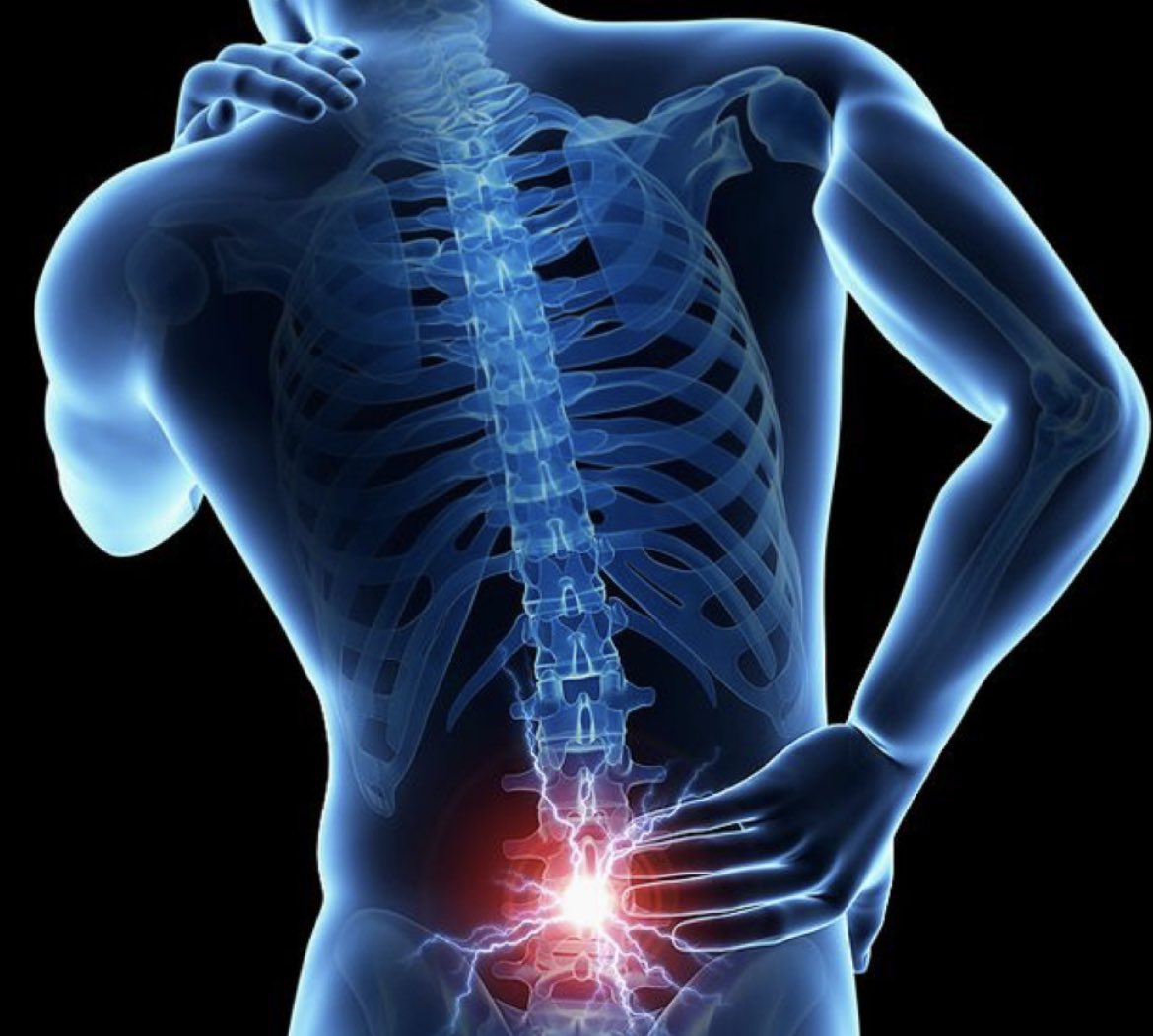 ثريد:

جمعت فيه جميع أسباب ألم الظهر اللي لازم يعرفها الأخصائي و المريض :

—بسم الله⬇️