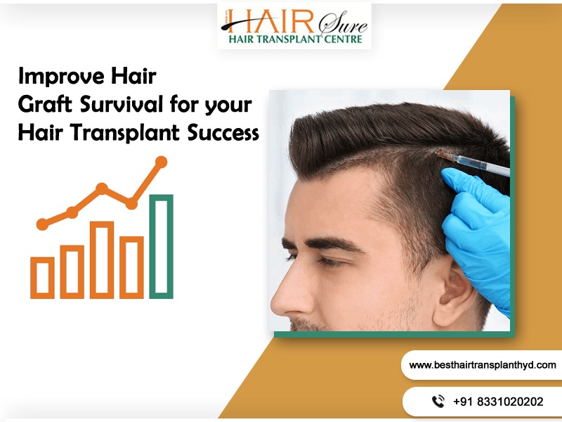 CYBER HAIR SURE (@sure_hair) / Twitter CYBER HAIR SURE (@sure_hair) / Twitter