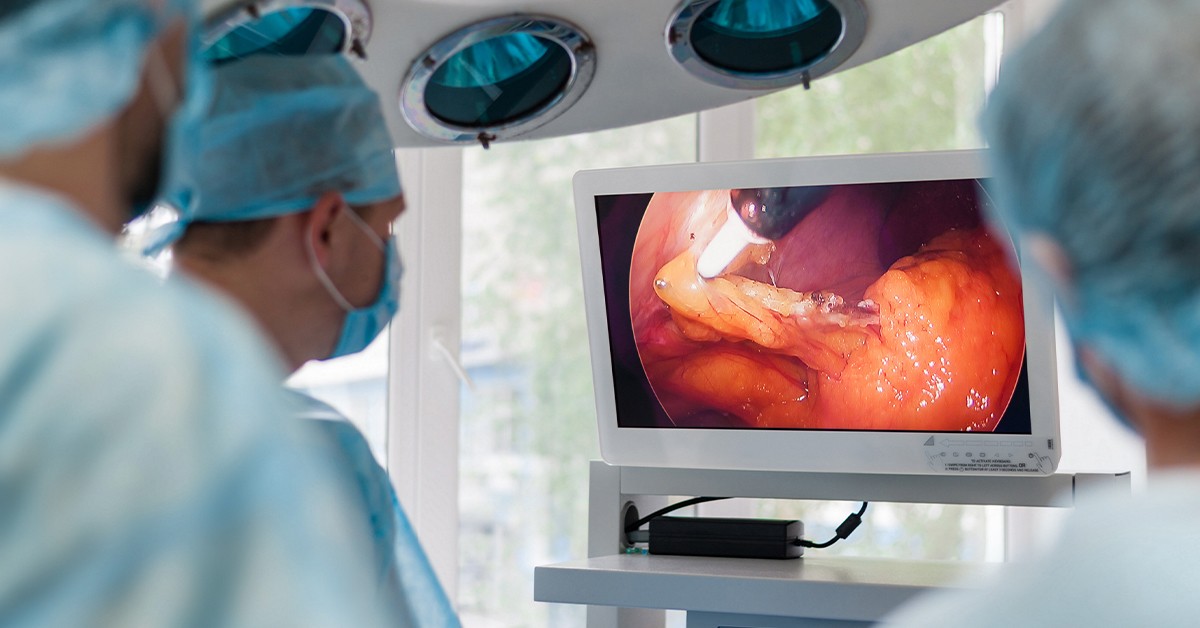 BISResearch's tweet photo. The use of #4K #technology is becoming more frequent in #healthcare because they are helpful in providing substantial picture detailing, giving #doctors more visionary options during a #surgery.
Read more: https://t.co/kHBKZK4nIA https://t.co/iGu6zigVB8