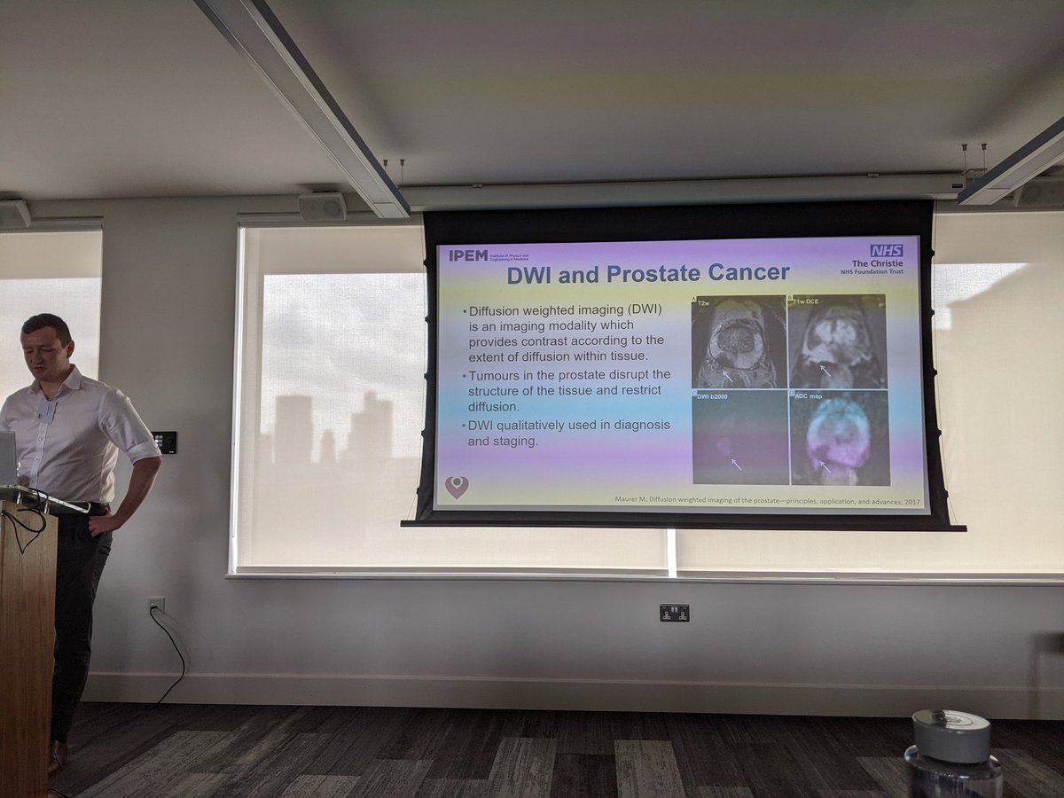 Christopher Moore explained a study which looked at adc values measured on the #unity linac for prostate patients over the course of treatment. No significant differences were seen in long course treatments or sabr #MRRT2022