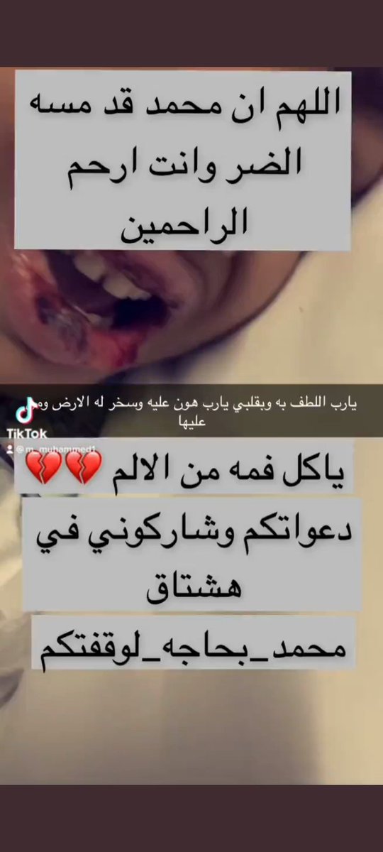 7HmnWxSL9wh8w00's tweet photo. #محمد-بحاجه-لوقفتكم" https://t.co/lnqYbYFhze