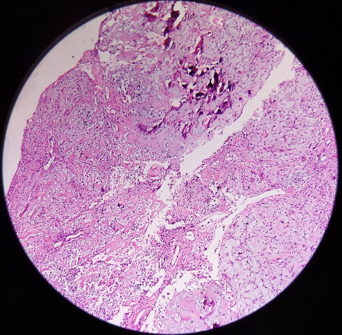 ViralBhanvadia's tweet photo. #headneckpath #headneckpathology @padmapathology1 @TristanRutland7 @nucleololailo @ashokparameswar @Shailee02742194 @01sth02 https://t.co/Z1IuttrINL