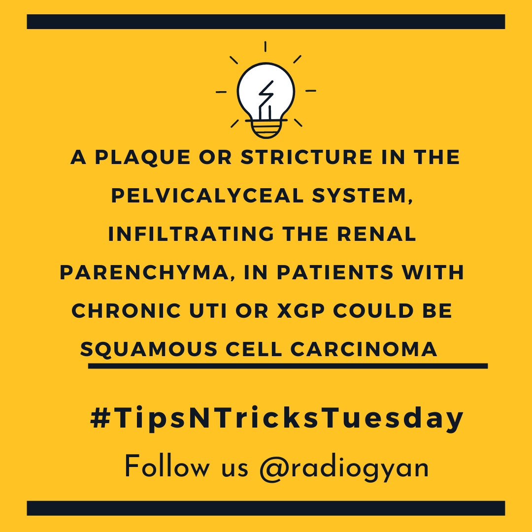 TeamRadioGyan's tweet photo. #TipsnTricksTuesday 

Here is a new pearl . 

All credits to #TeamGyan member Dr. Disha Lokhandwala.
Follow her on Instagram @dishasradiologyillustrations.

#gut #kidney #nephro #uro
#Foam #radres #radiogyan    
#radiology #education #internet https://t.co/iNnlXYjNSl