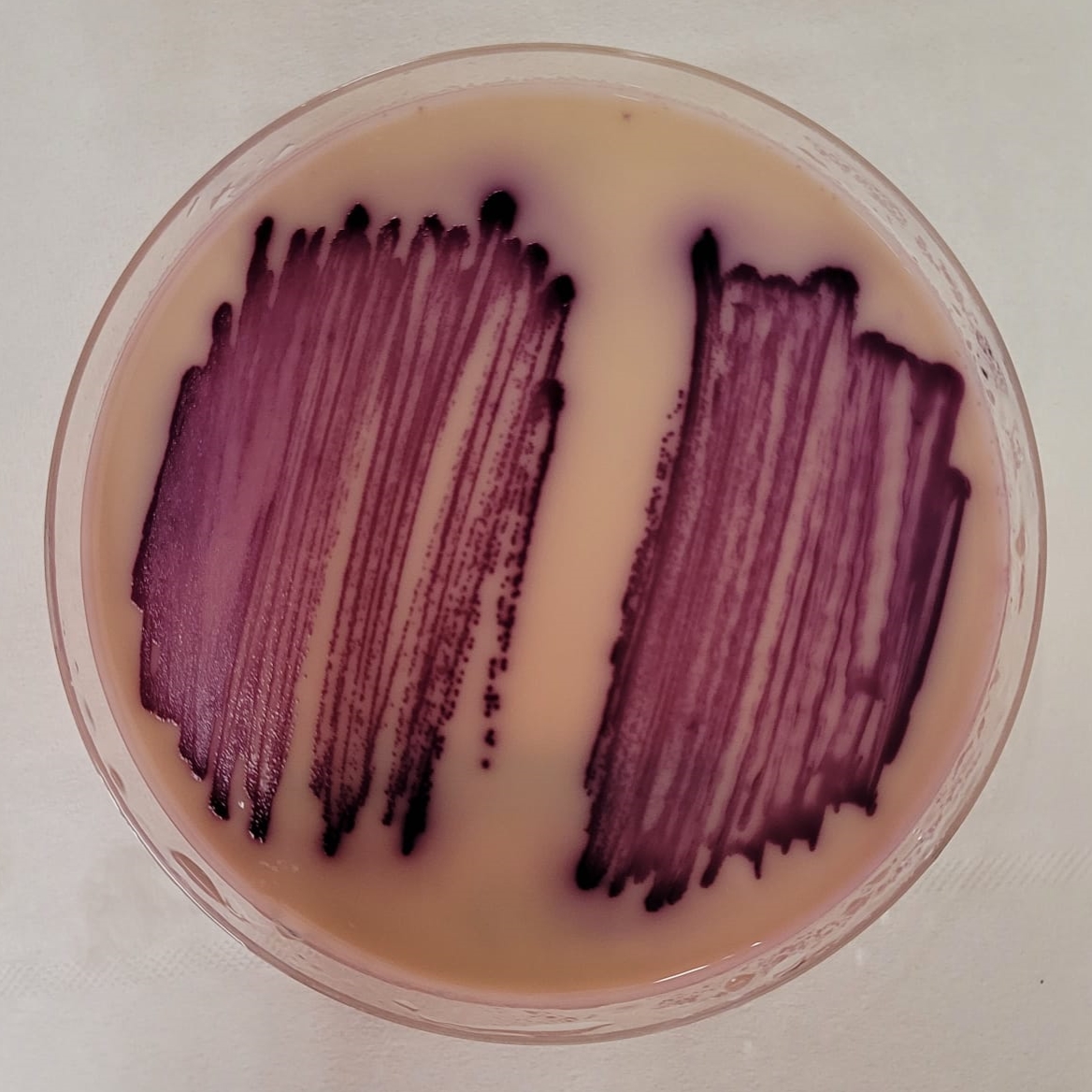 🦠The Art of Bacteria🦠

💎only at 
<a href="/cryptocomnft/">Crypto.com NFT</a>

collection link👉crypto.com/nft/collection…

💎All pictures are original and made by me in the Lab

#NFTGiveaway #NFT #NFTdrop #NFTshill #NFTs #BTC #art #nftart #NFTartist #ETH #CRO #NFTCommunity #NFTGiveaways #cryptocurrency