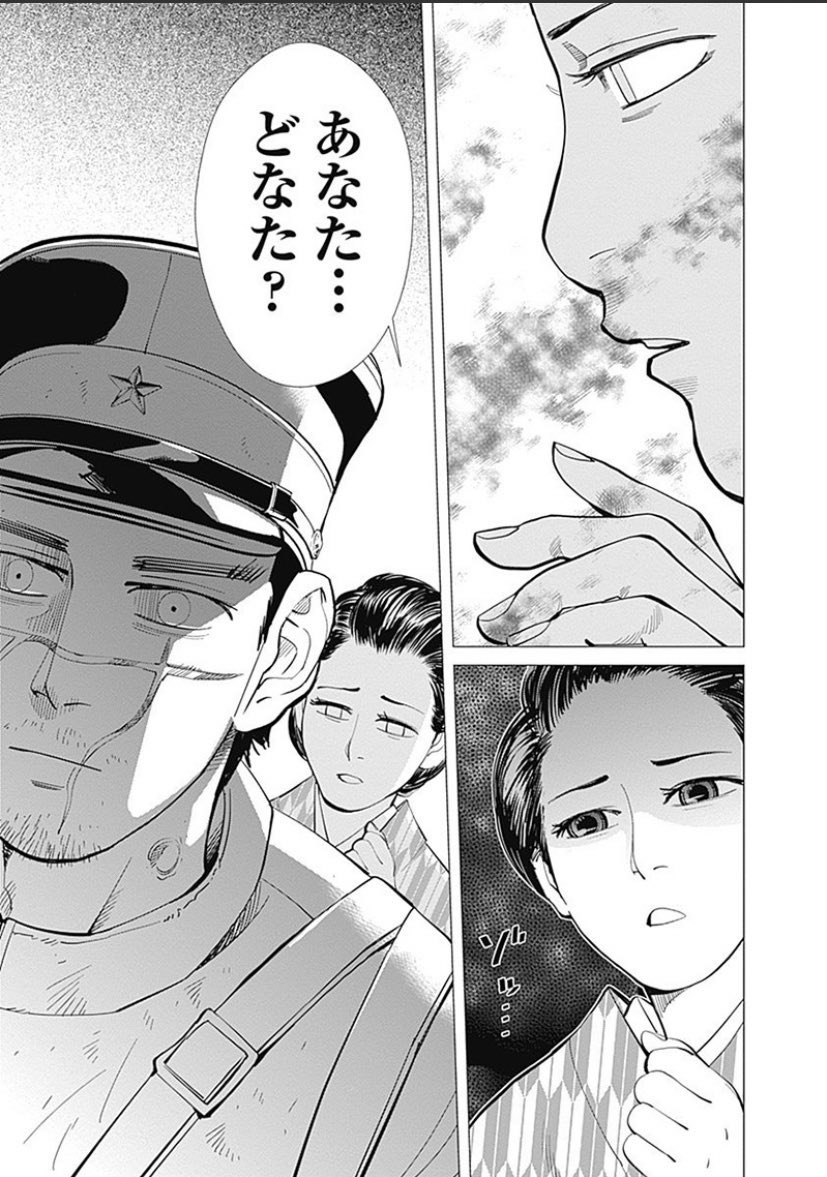 ゴールデンカムイ 梅子の人物像や杉元との関係は 再婚や手術についても紹介 3ページ目 Selvy