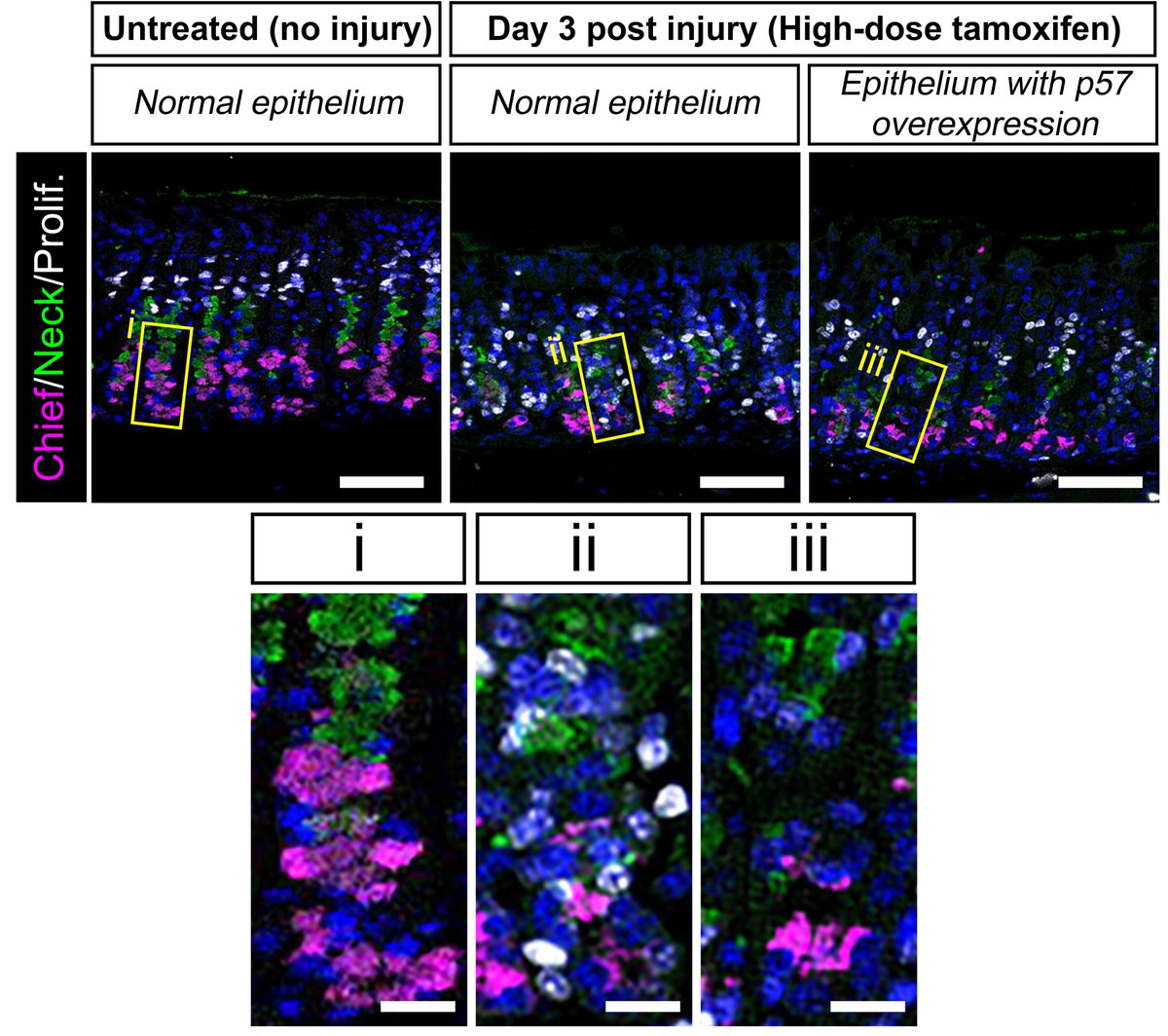 IMBA imbavienna.bsky.social (@imba_vienna) on Twitter photo Link to the publication in <a href="/CellStemCell/">Cell Stem Cell</a> ➡️ sciencedirect.com/science/articl…
#researchcollaboration with <a href="/ibbnida/">Eunyoung CHOI</a> (@VUMCSurgery <a href="/VanderbiltU/">Vanderbilt University</a>) & Jong Kyoung Kim (#POSTECH <a href="/CPostech/">Chemistry, POSTECH</a>)
#stemcellresearch #organoids #homeostasis #regeneration #WomenInSTEM #WomenInScience Link to the publication in <a href="/CellStemCell/">Cell Stem Cell</a> ➡️ sciencedirect.com/science/articl…
#researchcollaboration with <a href="/ibbnida/">Eunyoung CHOI</a> (@VUMCSurgery <a href="/VanderbiltU/">Vanderbilt University</a>) & Jong Kyoung Kim (#POSTECH <a href="/CPostech/">Chemistry, POSTECH</a>)
#stemcellresearch #organoids #homeostasis #regeneration #WomenInSTEM #WomenInScience