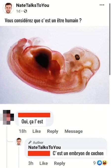 &Ccedil;a vieillit pas &ccedil;a https://t.co/nGsHqsLxaT