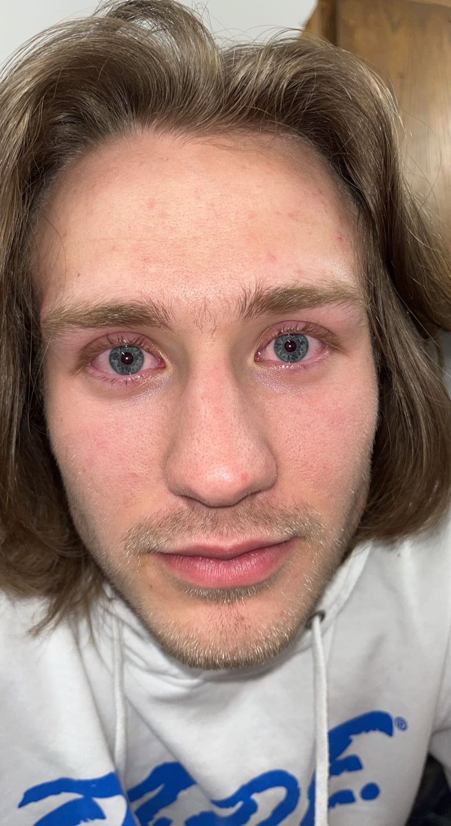 Player 4: Hustonlightning17
Strengths: Down for whatever😜, Fast Driver, Iron lungs
Weaknesses: Bad Allergies, Asthma