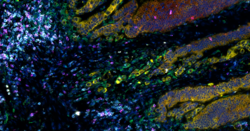 Visiopharm's tweet photo. We are thrilled to announce our new partnership with @Lunaphore to help arm researchers with the spatial biology tools they need to achieve quality, reproducible results. Learn more in our press release. #DigitalPathology
