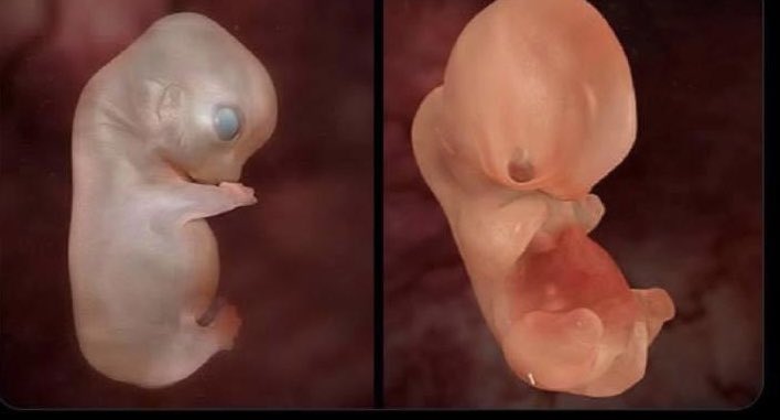 ItscalledaUvula's tweet photo. Do these look like human beings capable of living
on their own and making independent choices on
their own lives? https://t.co/gt4BhJtVS8