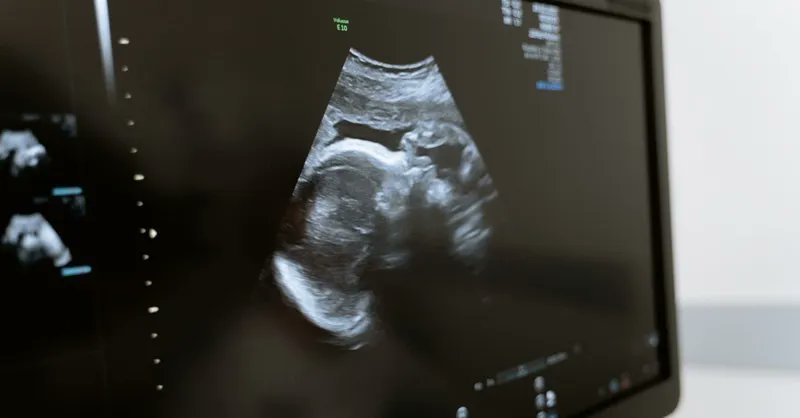 Sean_McDowell's tweet photo. 10 Things You Should Know about Abortion | Great post by Scott Klusendorf https://t.co/hmee5Ex41r https://t.co/gVFVaJDNlB
