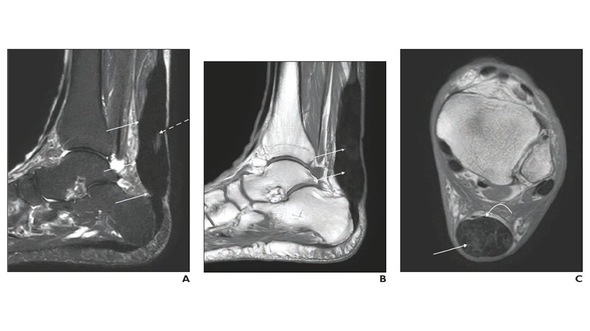 The Role of Sonographic Imaging to Assess the Pathophysiology of