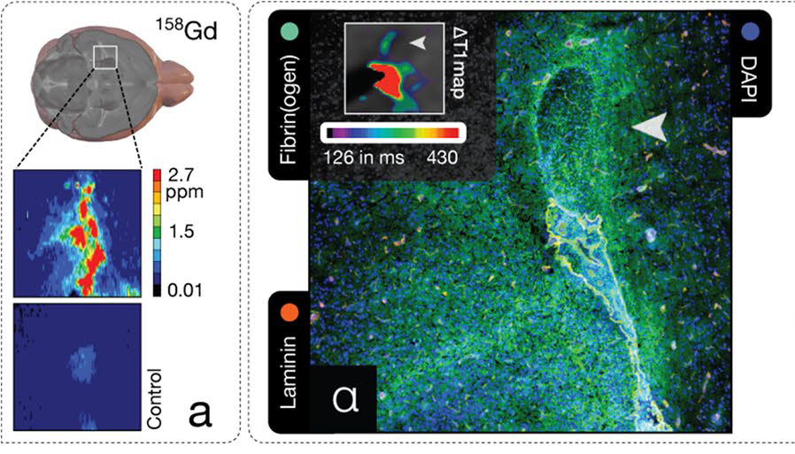 Exciting paper reporting the Fibrin-MRI probe by @PeterCaravan Marcus Makowski. Wonderful replication of our findings on fibrin in EAE w/ clinical implications for Fibrin-MRI as a non-invasive imaging biomarker for neuroinflammation & BBB disruption. 
link.springer.com/article/10.100…