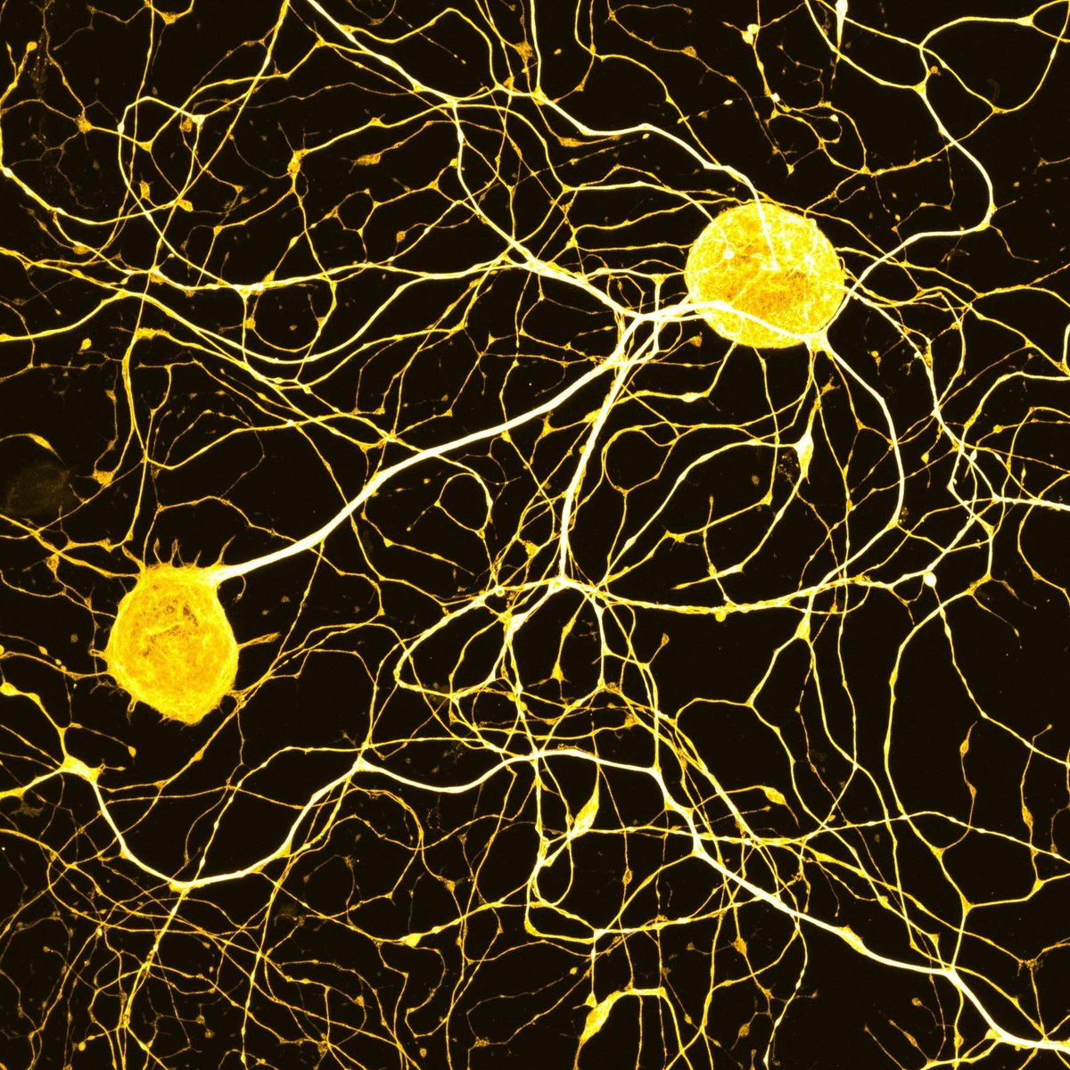 NikonInst's tweet photo. Our Plan Apo Lambda D series objectives provide an exceptionally flat field along with wide range chromatic aberration correction. Check out this image of DRG-derived sensory neurons acquired using the Plan Apo Lambda D 60X oil lens by Drs. Paolo Barzaghi and Marco Terenzio. https://t.co/yYReZCHYca