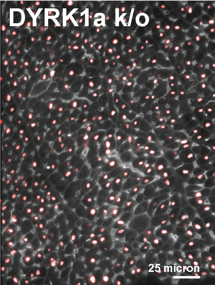 Young &amp; colleagues discover that inhibiting #DYRK1a kinase enhances #cardiomyocyte cycling and improves #heart function after injury. Learn more at ow.ly/Xc1x30si73V @MattWolfMD