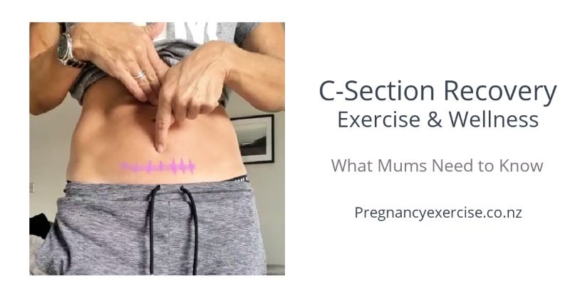 MummyTrainer's tweet photo. C-Section Recovery, Exercise and Wellness - https://t.co/vrMx703Um6 https://t.co/nixuR5piVv