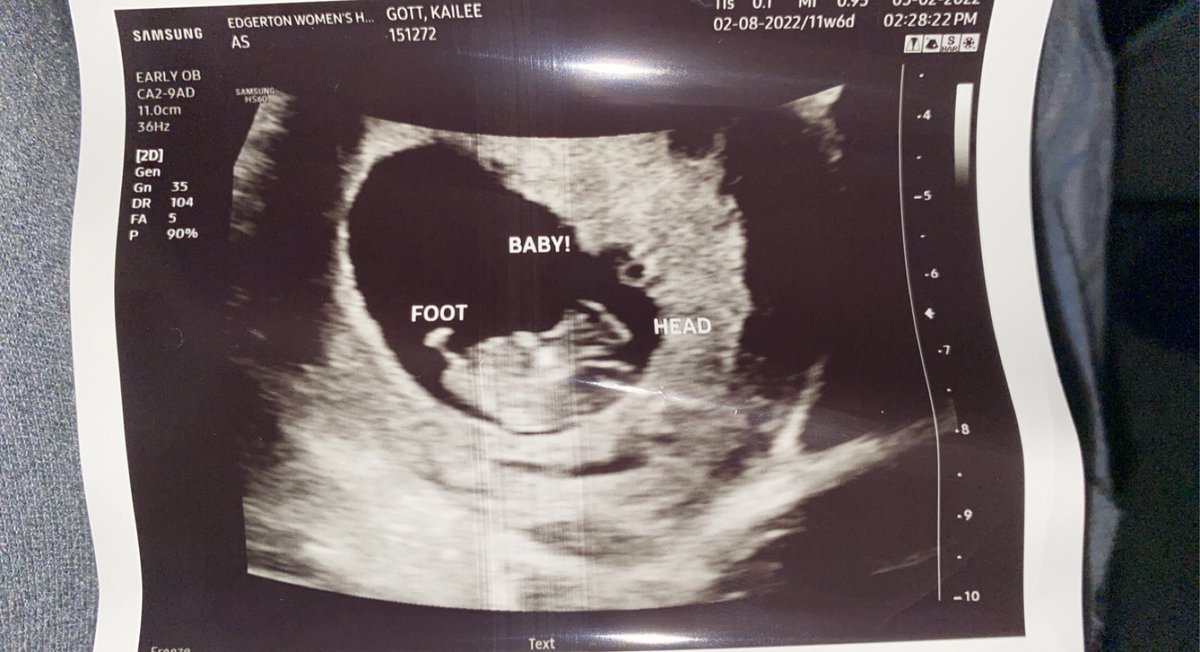 Lilith (@softsuccubus0) on Twitter photo Baby #2 on the way! <a href="/HappyBgg/">Brandon Charles</a> pretty soon youβll have enough for your own COD team ππ Baby #2 on the way! <a href="/HappyBgg/">Brandon Charles</a> pretty soon youβll have enough for your own COD team ππ