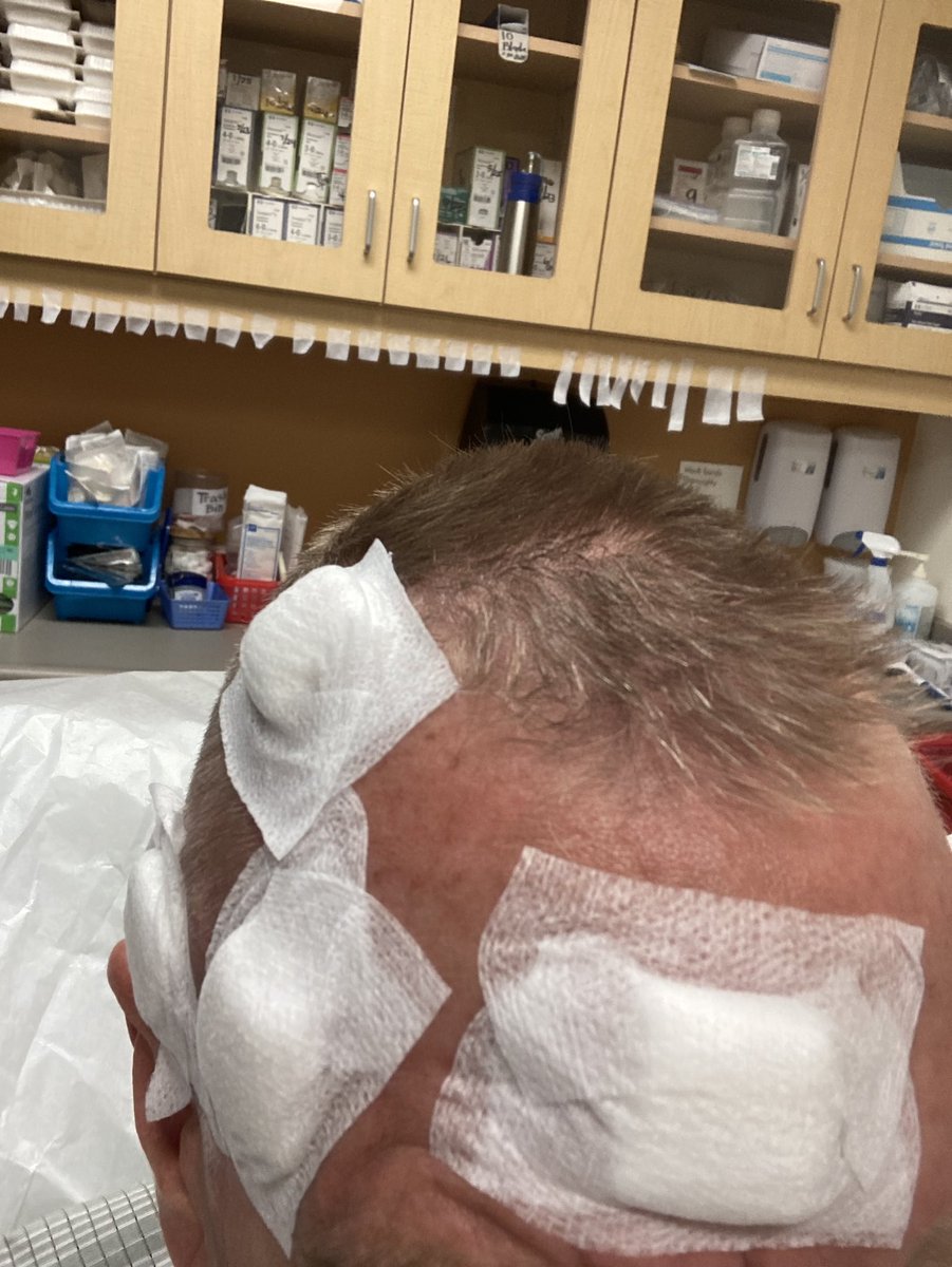 stompnstu's tweet photo. PSA. Watch your sun exposure Use SPF clothing and whatever form of cream or ointment while out in the sun. https://t.co/bSHIliP3hN