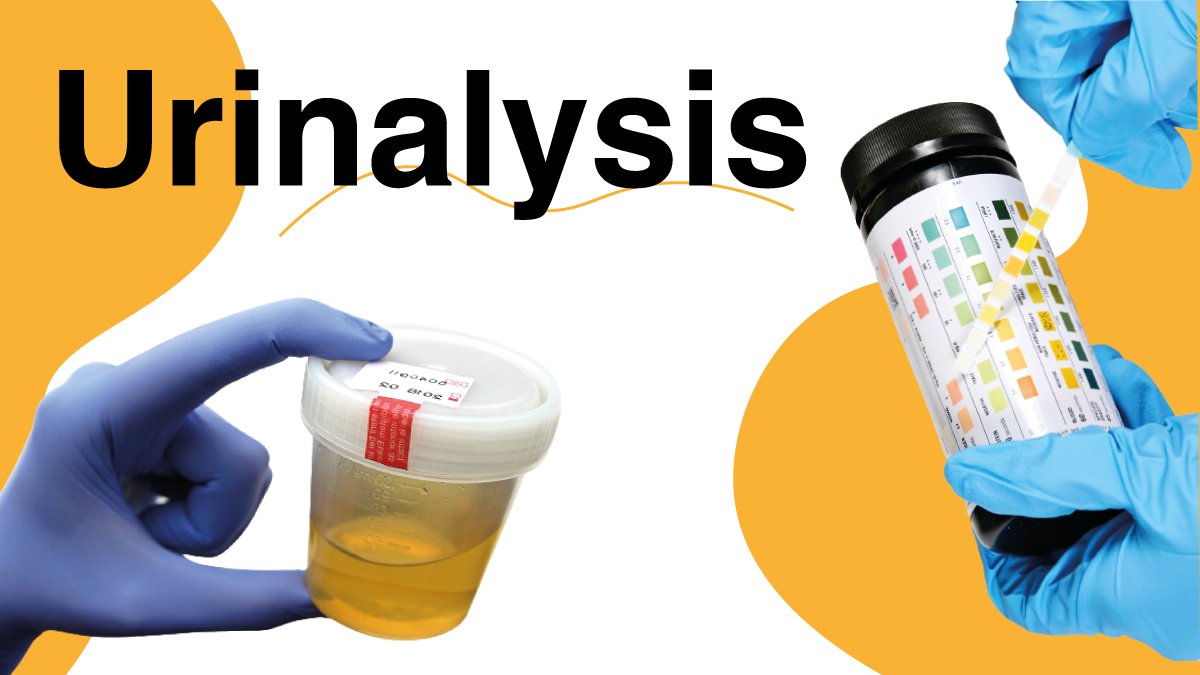 Natalia51796607's tweet photo. 1. Hello #MedTwitter the topic of today is going to be urinalysis...(maybe you will look at your pee more often after this!) @MedTweetorials @Medact @YusufKarmali 

1/12 https://t.co/C42xYnNcwz