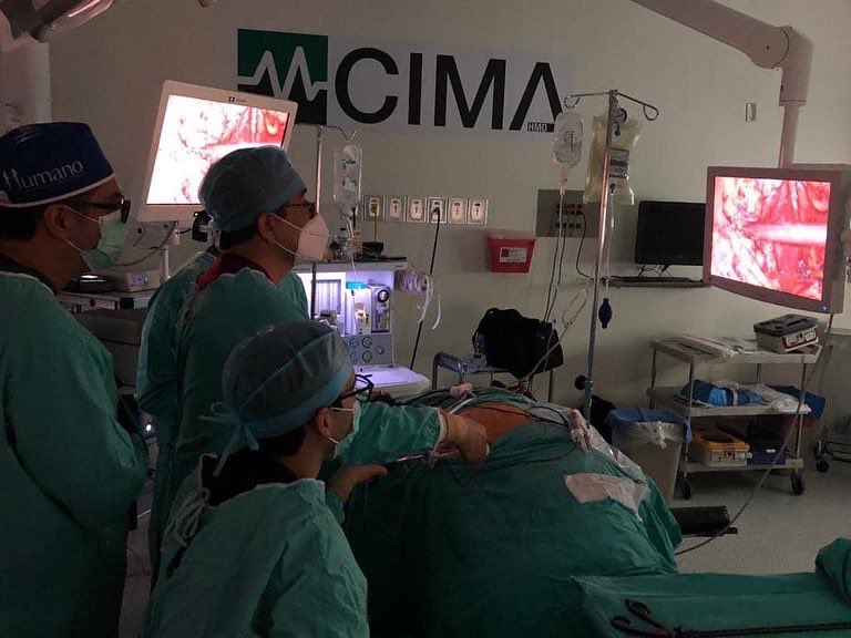 #CáncerdeRiñón 

Cirugía laparoscópica para retirar un tumor de riñón cuyo peso fue mayor a los 1200 gramos. 

Los factores de riesgo para esta enfermedad son: tabaquismo, hipertensión arterial y obesidad, entre otros. 

Gracias a los pacientes y familiares por su confianza