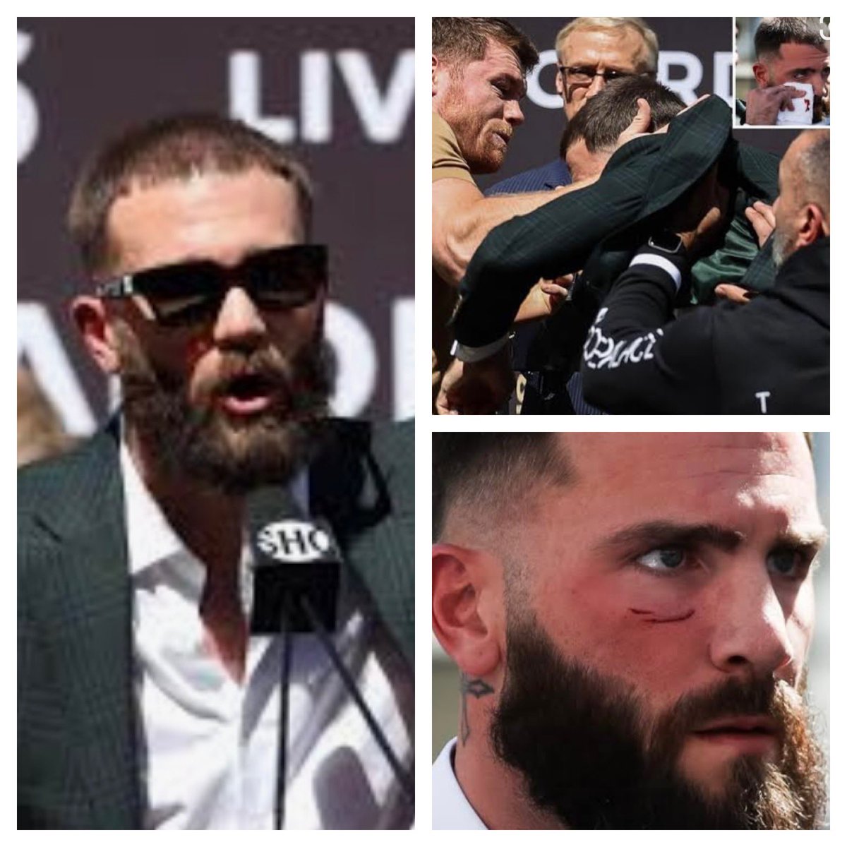 Algo así ocurre cuando te estrellan los lentes en la cara... A menos que estés mintiendo y ningún periodista domesticado sería capaz de mentir. 
¿Verdad?