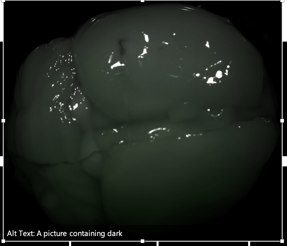 doc_doc_goose47's tweet photo. Highly recommend using PowerPoint auto-caption on pics of mouse organs, if you need a reminder of how far we still are from ML running the world https://t.co/2PCv41JzDe