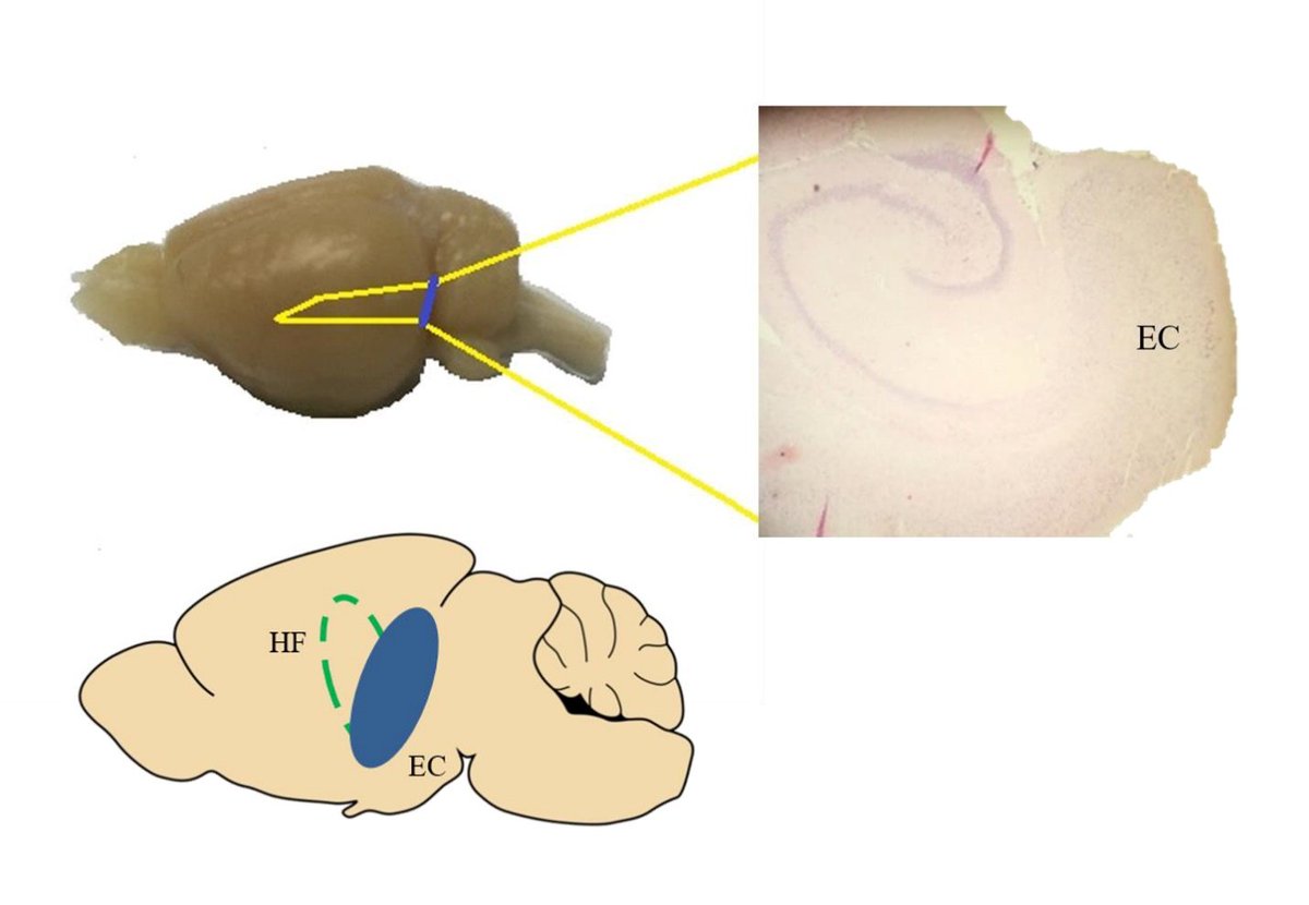 JINeuroscience's tweet photo. @JINeuroscience Acute application of Centella asiatica extract enhanced AMPAR-mediated #postsynaptic currents in rat entorhinal #cortex by Dr. Jafri Malin Abdullah @neuronman @USMOfficial1969. Universiti Sains #Malaysia
https://t.co/H4fACK78WY
#Centella_asiatica #AMPAR https://t.co/OgwrmBCH4o