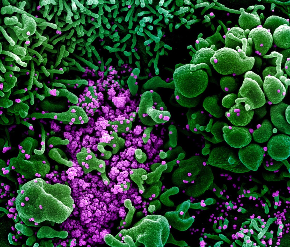 NewsMedical's tweet photo. SARS-CoV-2 variants are not evolving to escape from T cell-mediated immunity https://t.co/3yzgC9kOcx #TCell #Immunity #SARSCoV2 #Coronavirus #Disease #COVID #ORF8 @biorxivpreprint @YaleMed @HHMINEWS @Yale https://t.co/ovMVEQmkMn