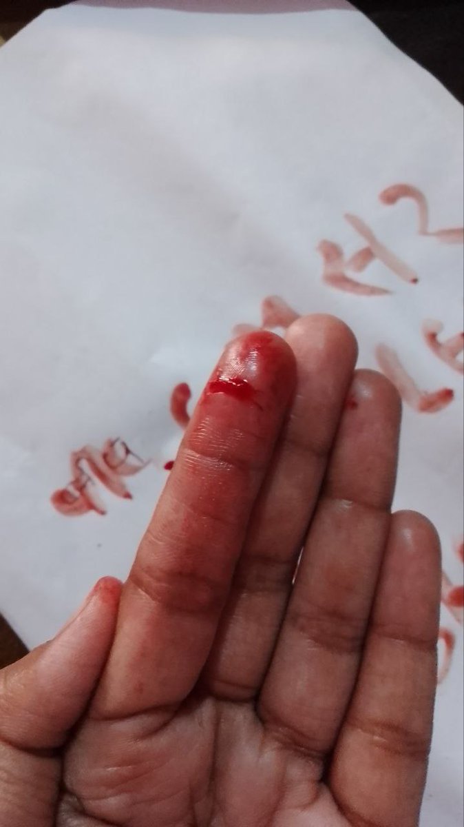AravindEtukela's tweet photo. #POSTPONENEETPG2022_MODIJINEETPG 
This shows how desperate we are towards postponement Sir🙏
@mansukhmandviya @MoHFW_INDIA @PMOIndia @AmitShah 
@narendramodi 
This isn't pain at all when compared to our woes
#postponeneetpg2022please https://t.co/V8s06lF2G0