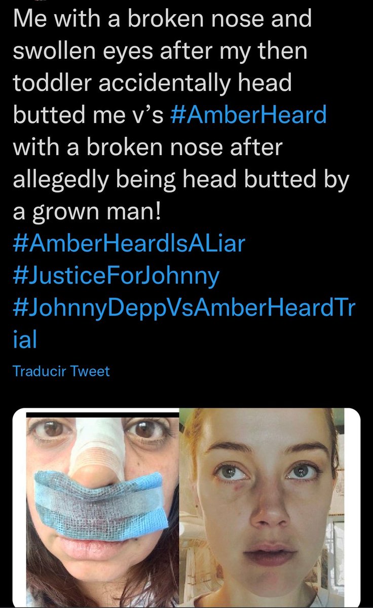 Paulxheda98's tweet photo. se me pone la piel de gallina viendo testimonios de víctimas reales de violencia de género lógicamente dolidas y cabreadas por tener que aguantar a esta persona inventandose su historia 

#JusticeForJohnnyDepp 
#AmberHeardlsALiar https://t.co/NM2jsDYxNF