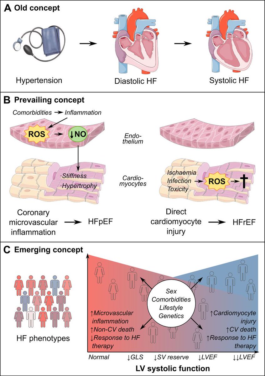 Heart failure with preserved ejection fraction: recent concepts in diagnosis, mechanisms and management bit.ly/3ozgb9z