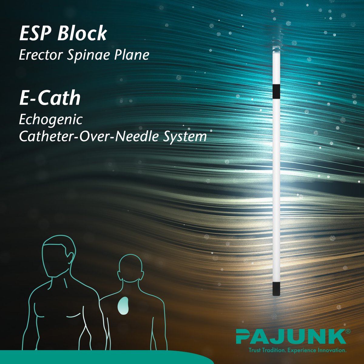 Pajunk_Global's tweet image. 📍#ESPBlock (Erector Spinae Plane)

#Pajunk Product Recommendation: 
E-Cath® - Echogenic Catheter-Over-Needle System

More at zcu.io/9zQJ 

#pajunkinnovation #fascialplaneblocks #fascialblocks  #blockguru  #regionalanesthesia #pajunkfascial #fascianatingfriday