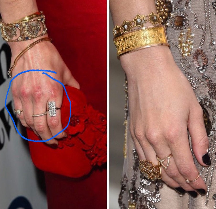 GasPrices5's tweet photo. Zoom in on Ambers scabbed and swollen knuckles on her right hand. Ding ding ding all #JohnnyDepp’s facial injuries on the left side. #JusticeForJohnnyDepp #AmberHeardlsALiar #amberheardisapsychopath #AmberHeardlsALiar #amberheardisapsychopath #JohnnyDeppVsAmberHeardTrial https://t.co/ZXU5T7w8Fu