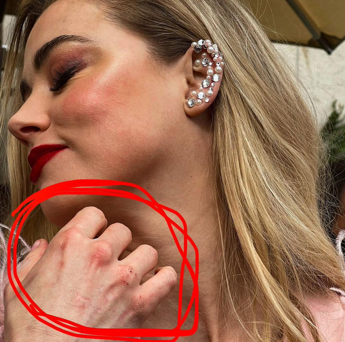 GasPrices5's tweet photo. Zoom in on Ambers scabbed and swollen knuckles on her right hand. Ding ding ding all #JohnnyDepp’s facial injuries on the left side. #JusticeForJohnnyDepp #AmberHeardlsALiar #amberheardisapsychopath #AmberHeardlsALiar #amberheardisapsychopath #JohnnyDeppVsAmberHeardTrial https://t.co/ZXU5T7w8Fu