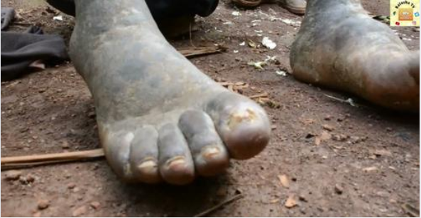 bafashe's tweet photo. Kubabara umutsi w'ino rikuru vyamuviriyemwo ubumuga bw'amaguru yose./Jéremie imyaka 3 agenda yicaye #MWUMBA #NGOZI #BURUNDI  https://t.co/M67xJ3IHg6 https://t.co/qM5lK81wJg