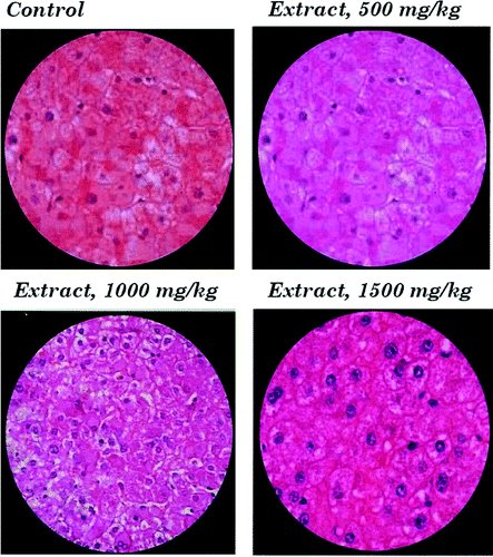 The importance of neural stem cell survival in the appropriate brain function, synapsis formation, and neural cell communication is to the degree that any perturbation in this process leads to many neurodegenerative diseases. 
#OpenAcces #ReGENopen liebertpub.com/doi/10.1089/re…
