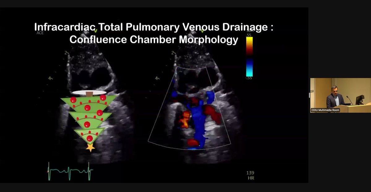 SKHeartCentre's tweet photo. Entertaining and memorable session by #SKCardio's Dr Vitor Guerra discussing pulmonary vein anomalies #SKEchoSymposium #TAPVD #Echo https://t.co/LgAuyjzPfD