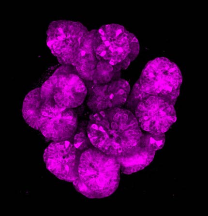 micromindy's tweet photo. I always enjoy it when experiments look like something else... I think these intestinal organoids look a lot like a bouquet peonies #fluorescentfriday #organoid #organoids #enteroid #enteroids #intestine #imageoftheday https://t.co/ZMpR7KsKKm