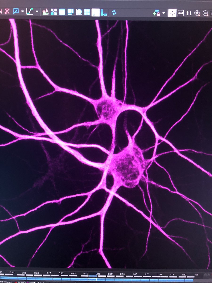 saskiajpollack's tweet photo. Friday #cellfie ! Entangled neurons captured on a @NikonInst A1R confocal microscope at @KCLWCIC #when2become1 💜 https://t.co/5N5w6poqiy