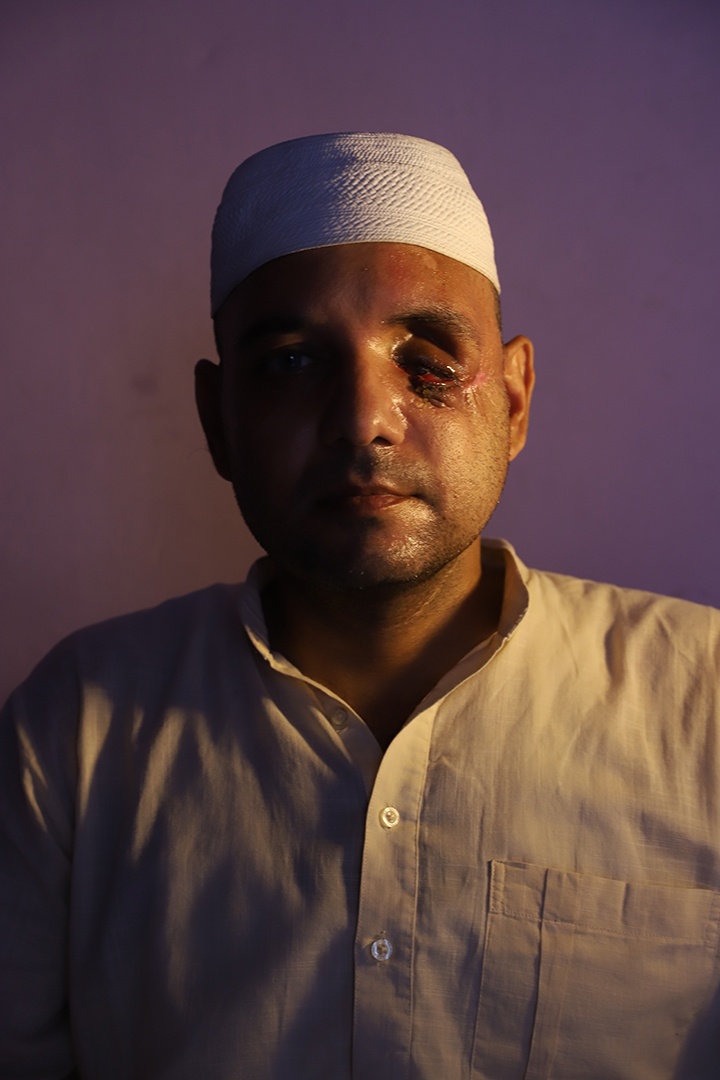 thecaravanindia's tweet image. Nasir Khan has alleged that Naresh Tyagi shot him in the eye during the Delhi violence. Another person has said they witnessed this. But even two years on the Bhajanpura police station has still not registered the FIR, despite a court rebuking them for it.
bit.ly/3KBcmZA