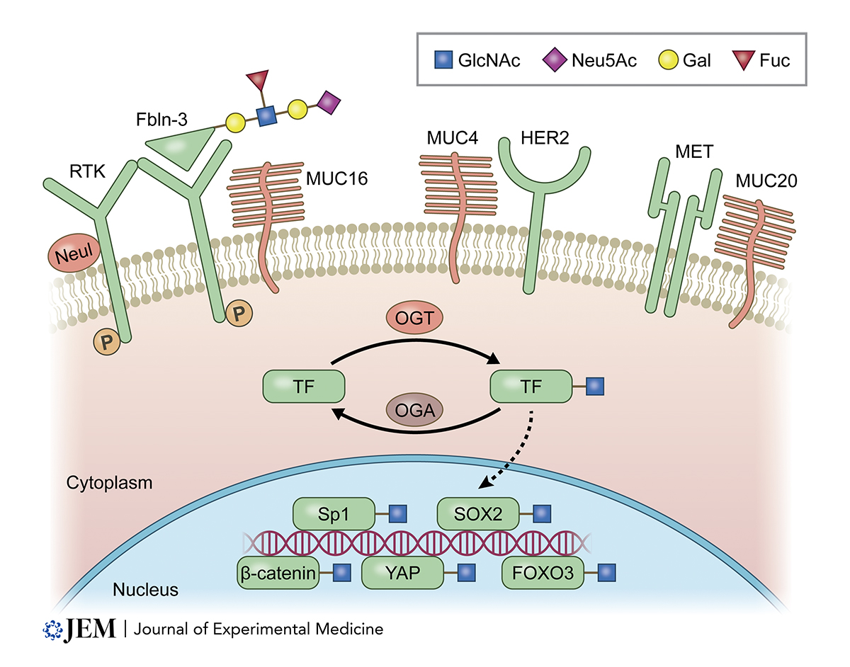 Journal of Experimental Medicine (@jexpmed) on Twitter photo In this #CancerFocus review, <a href="/J_Lumibao/">Jan Lumibao</a>, <a href="/JacobRTremblay/">Jake Tremblay</a>, Hsu & <a href="/DannieEngle/">Dr. Dannie</a> <a href="/EngleLabSalk/">Engle Lab</a> discuss the contributions of aberrant glycosylation to protumorigenic signaling, metastasis, & remodeling the tumor immune microenvironment in #PancreaticCancer. bit.ly/3kN5EFu In this #CancerFocus review, <a href="/J_Lumibao/">Jan Lumibao</a>, <a href="/JacobRTremblay/">Jake Tremblay</a>, Hsu & <a href="/DannieEngle/">Dr. Dannie</a> <a href="/EngleLabSalk/">Engle Lab</a> discuss the contributions of aberrant glycosylation to protumorigenic signaling, metastasis, & remodeling the tumor immune microenvironment in #PancreaticCancer. bit.ly/3kN5EFu