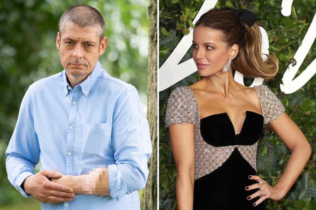 PageSix's tweet image. Man who grew penis on arm wants to date Kate Beckinsale trib.al/BGRQkfF