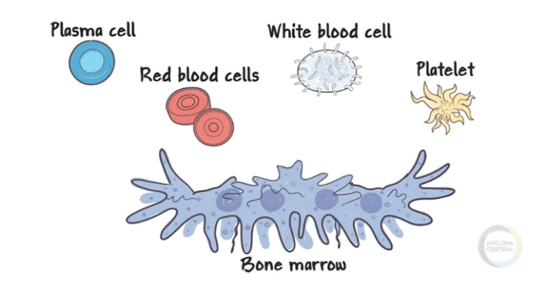 BMS_Myeloma_US's tweet photo. #HemOnc #HCPs: do your patients living with #myeloma know the phrase minimal residual disease? Perhaps they’ve heard you say it but don’t know what it means. Share this video, which breaks it all down in patient-friendly terms #mmsm