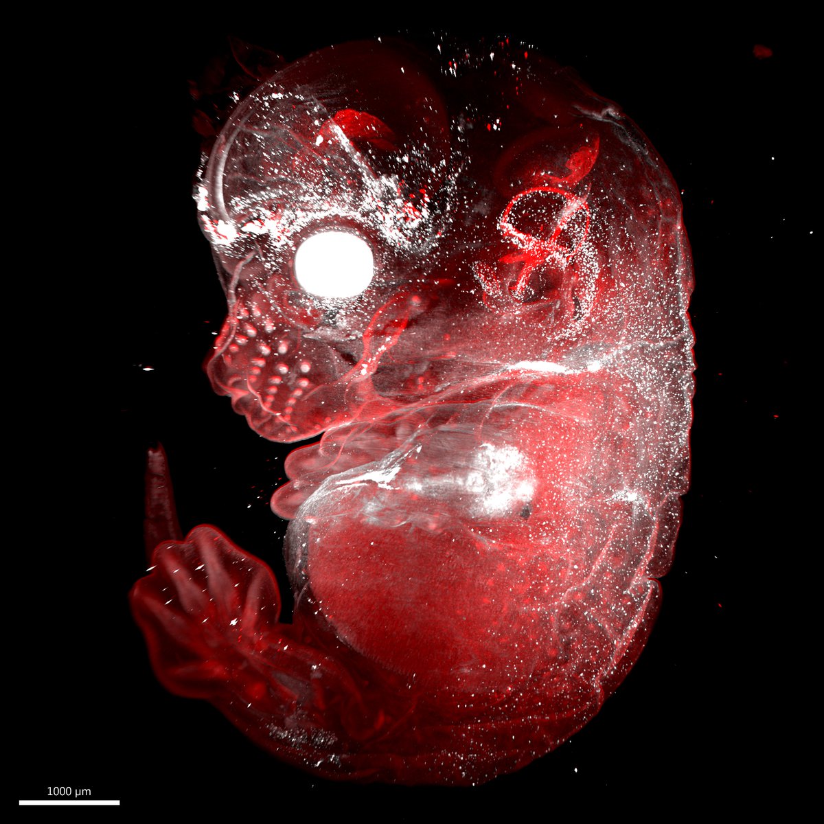 Melanoblast cells migrating through the skin from the neural crest in an e13.5 embryo.
By: <a href="/BRaftrey/">Brian Raftrey</a>
PI: Ya-Chieh Hsu
LaVision Lightsheet Microscope