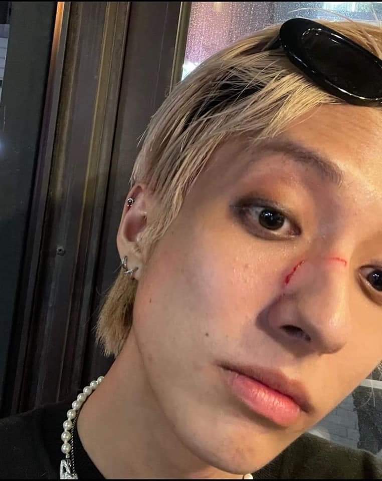 Charsxavier23's tweet photo. Con mucho sentimiento y con mucha indignación estoy viendo este tipo de acoso, hasta llegar a la violencia al actor #Holland, Te apoyo incondicionalmente #WeSupportYouHOLLAND, hay que denunciar al agresor y que pague por los dos físicos, moral y psicológicos https://t.co/WLSObEb03J