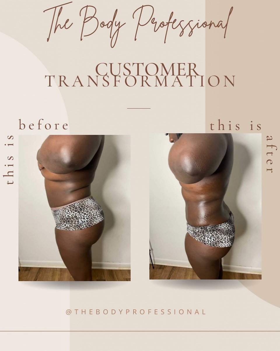 TheBodyPro_'s tweet photo. HEY MAMA'S AND LADIES 👋🏾 . I HAVE A MEGA SALE RUNNING ALL MONTH DEDICATED TO MY MOTHERS 😌❤️. As mommies our bodies go through so many changes! We gain weight and our body stretches and so much more. Being a mother myself I completely understand.#Atlanta #atlantabodycontouring https://t.co/lWBlso0gKr