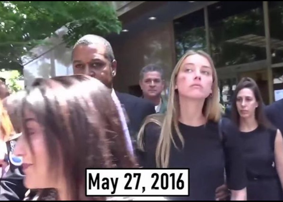 roaringrapids22's tweet photo. Amber Heard attempted to extort Johnny Depp for money, penthouses, a Range Rover, stating if her demands weren't met, she would make allegations against him. When he refused to be extorted, she filed a fraudulent request for a TRO w/ a "fake" bruise, that magically disappeared. https://t.co/IslcNpmqeH