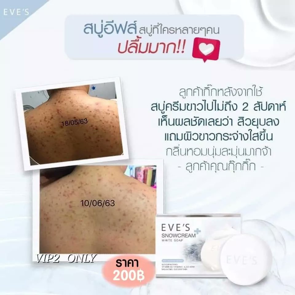 EvesWayu's tweet photo. รีวิวสบู่มาแล้วจ้าาา 😍 

ผิวใสขึ้นอย่างเห็นได้ชัด โดยลองใช้ข้างเดียว มา10วัน 💕 

✔️ขาวไวกว่าเดิม 
✔️สิวหายไวกว่าเดิม 
✔️ฆ่าเชื้อไวรัสได้ด้วย

**สูตร anti bacterial ฆ่าเชื้อไวรัส 99.99%

#สบู่อีฟส์ 200 บาท/130 g
เลขที่จดแจ้ง : 73-1-6300018514

#รับสมัครตัวแทนจำหน่ายทั่วประเทศ https://t.co/7vUNpyheBh